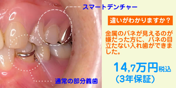�X�}�[�g�f���`���[